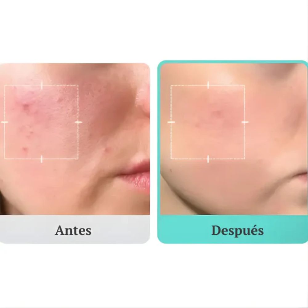 Medicube Azelaic Acid 16 BB Calming Serum 30ml