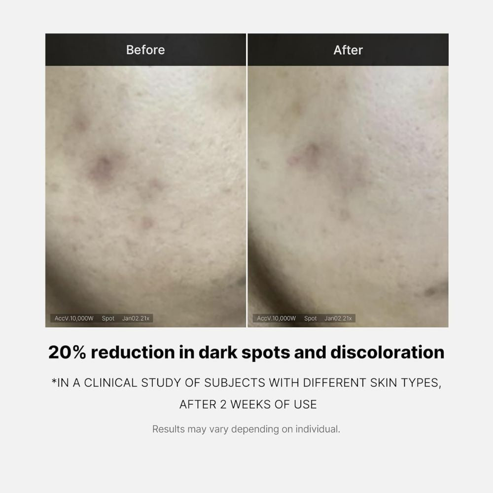 Medicube Deep Vita C Ampoule Kit 3 Und