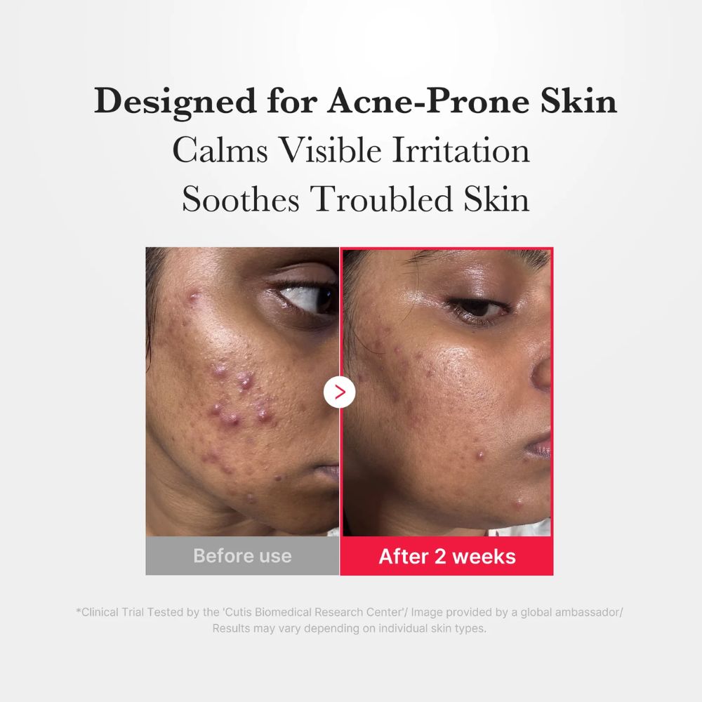 Medicube Hypochlorous Acid Daily Facial Spray 50ml