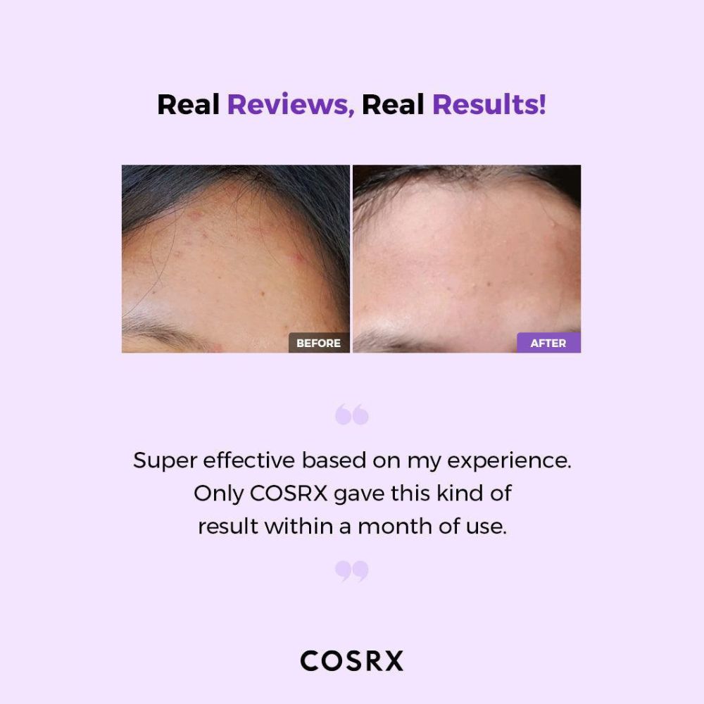 COSRX AHA/BHA Clarifying Treatment Toner 150ml