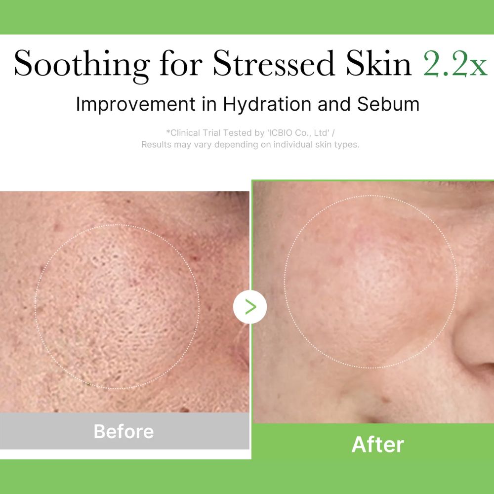 Medicube Exosome Cica Cream 50ml