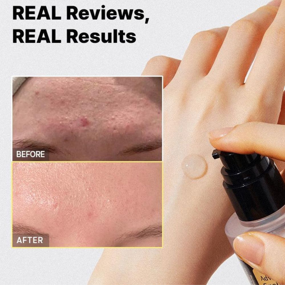COSRX Advanced Snail 96 Mucin Power Essence 100ml