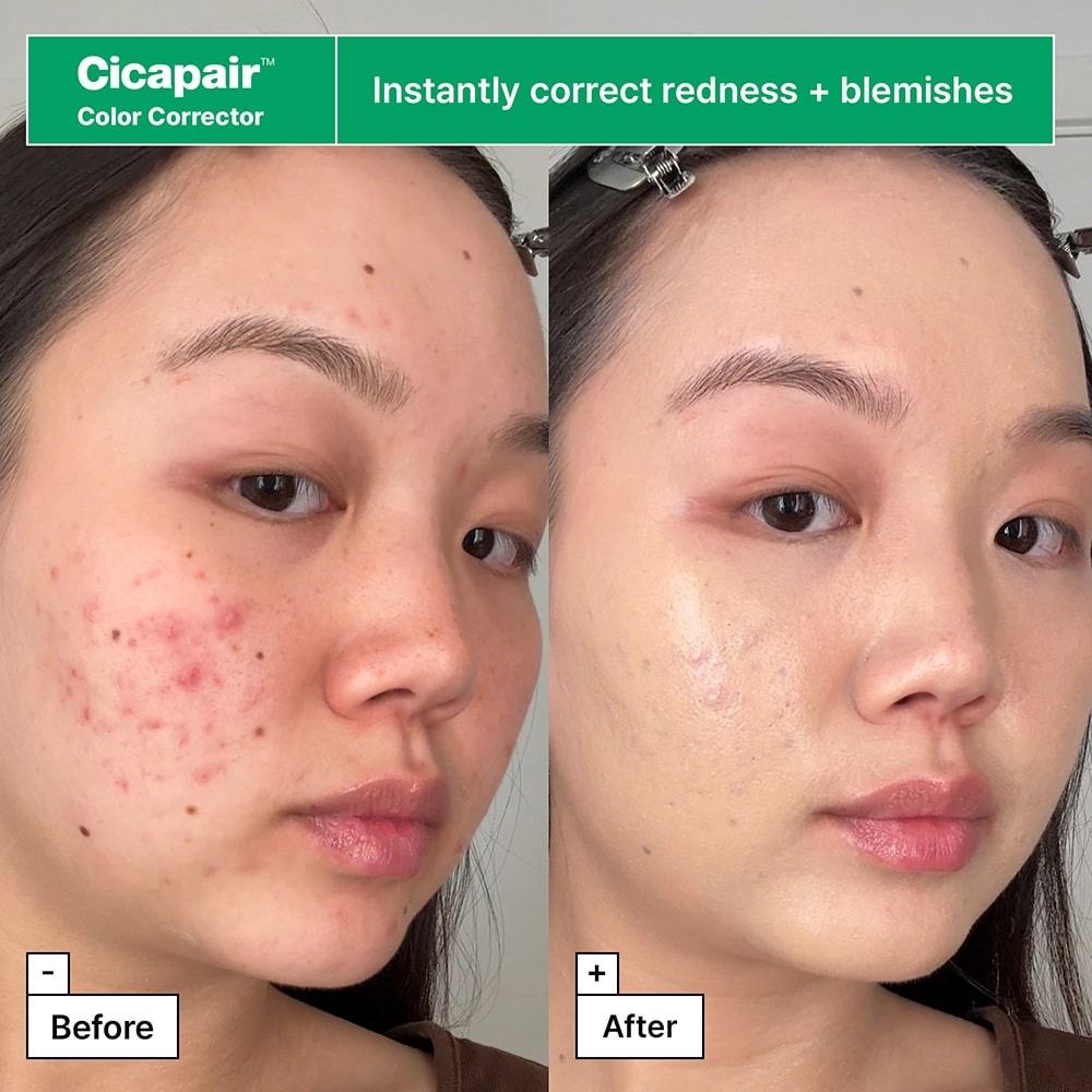Dr Jart Kit Cicapair Redness Rescue Regimen 4 Und