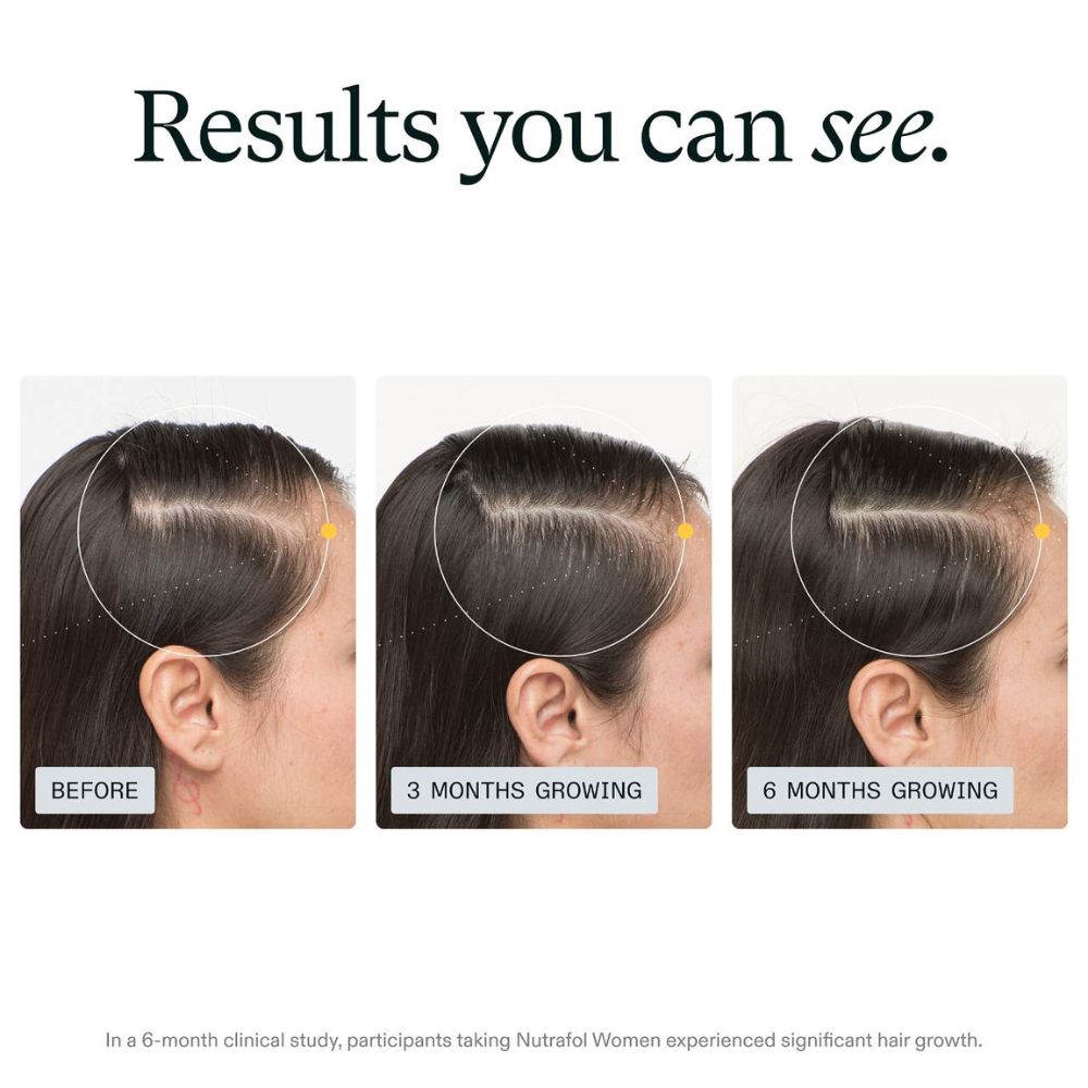 Nutrafol Women Balance Hair Growth Nutraceutical Dietary Suplement 120 Capsulas