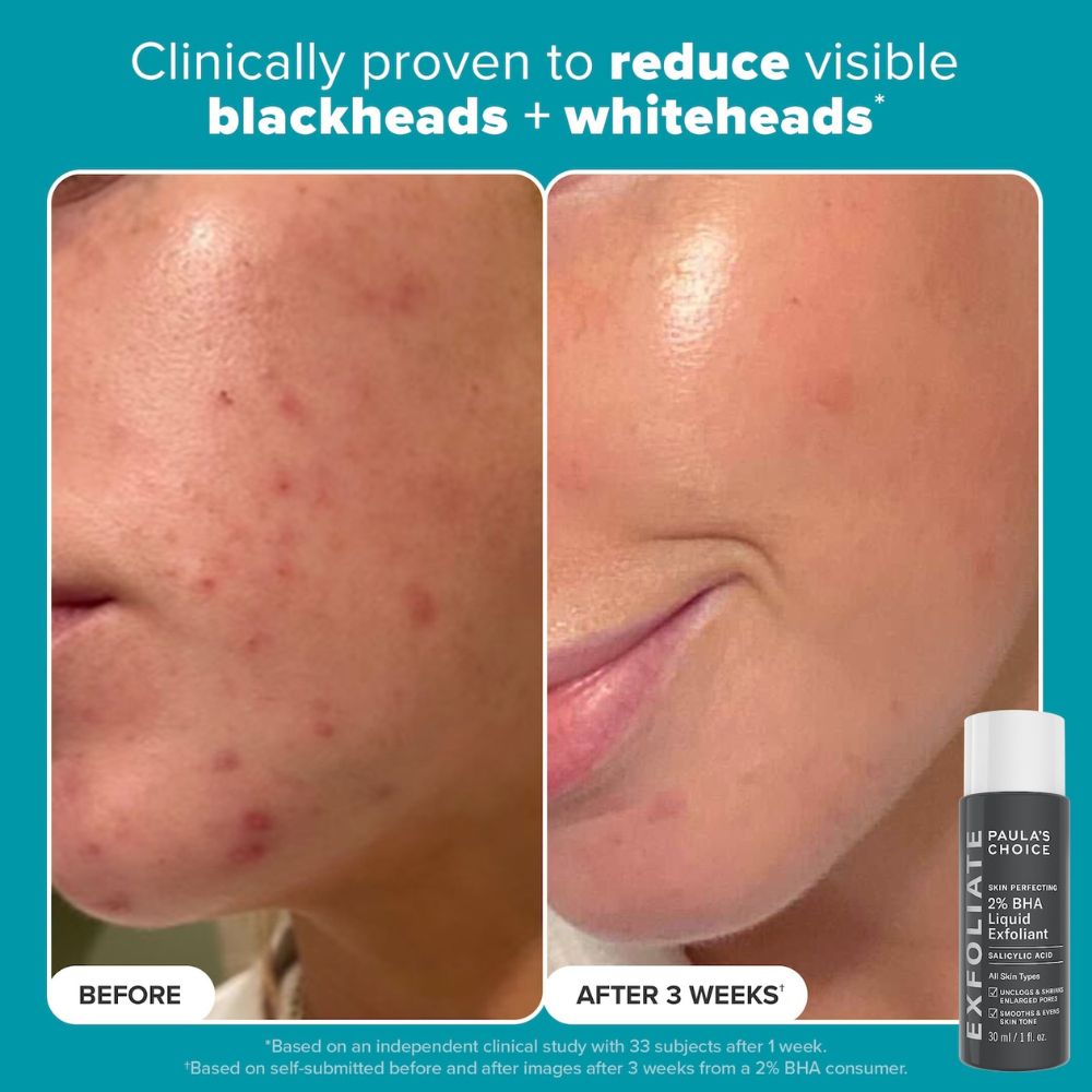 Paula's Choice Skincare Exfoliation Icons Kit