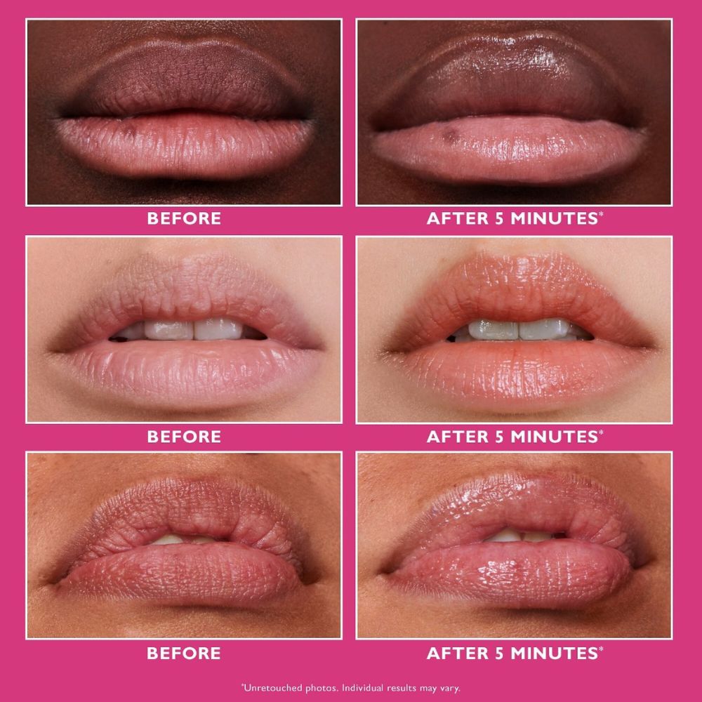Peter Thomas Roth Instant Firm Lip Filler 10ml