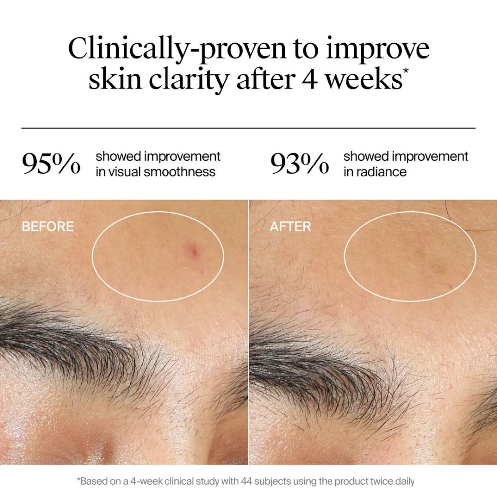 Neutrogena Evenly Clear Acne Gel Moisturizer 50g